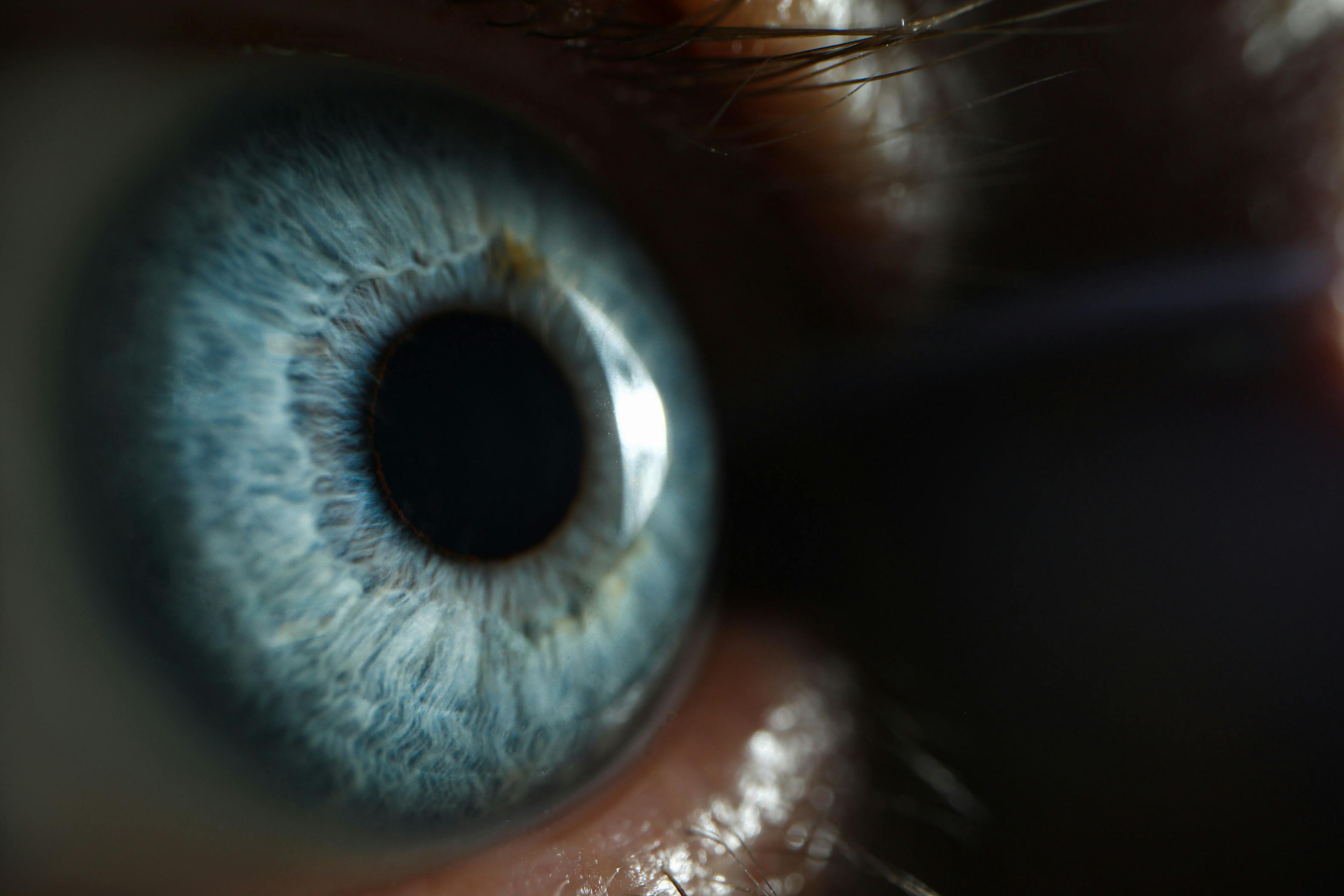 retina, glaucoma disease monitoring