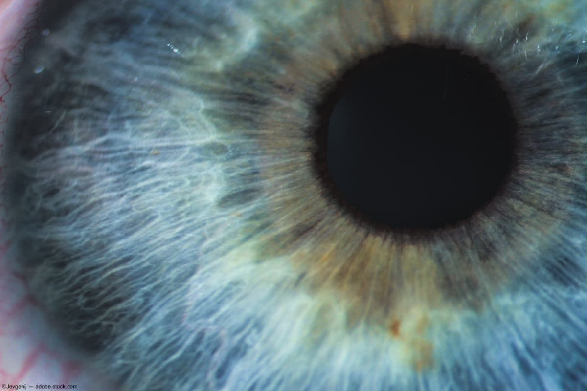 Researchers examine novel mechanism of retinal degeneration