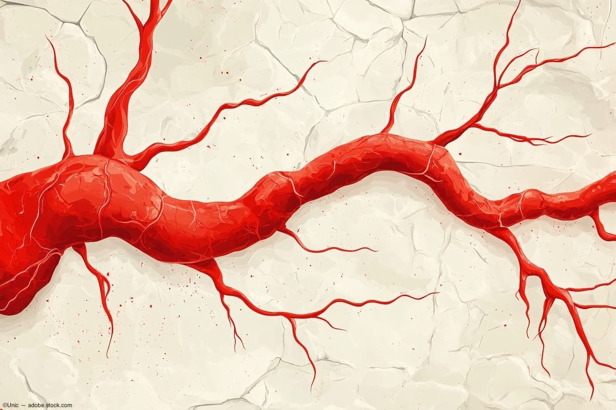 Changes in retinal microvasculature in preclinical Alzheimer’s disease