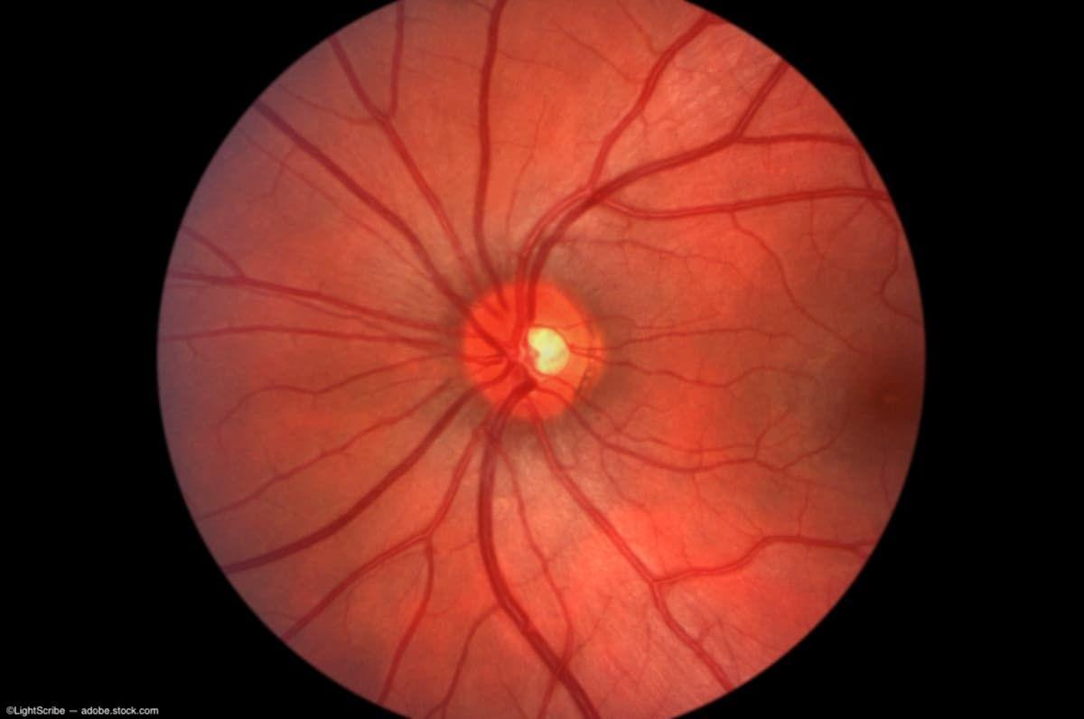 NIH researchers discover potential therapeutic target for degenerative eye disease