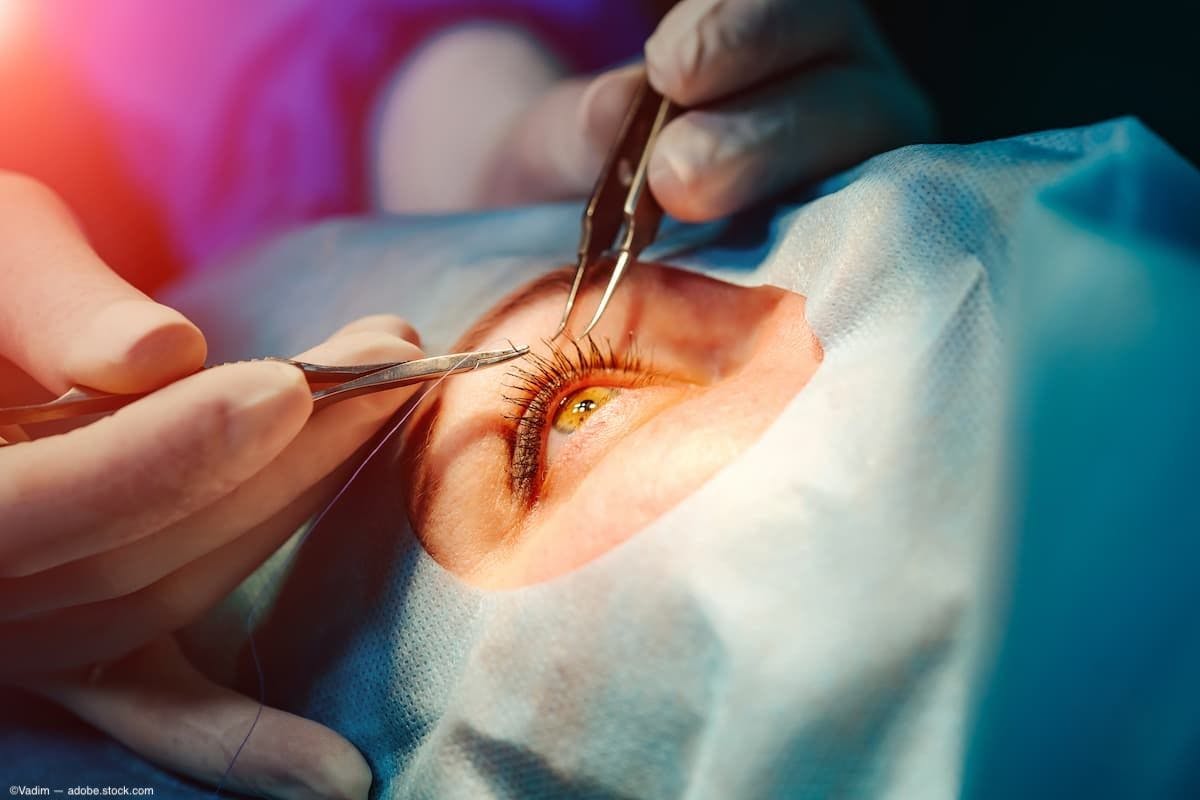 ASRS 2024: External exposures affect retina surgeons’ dexterity