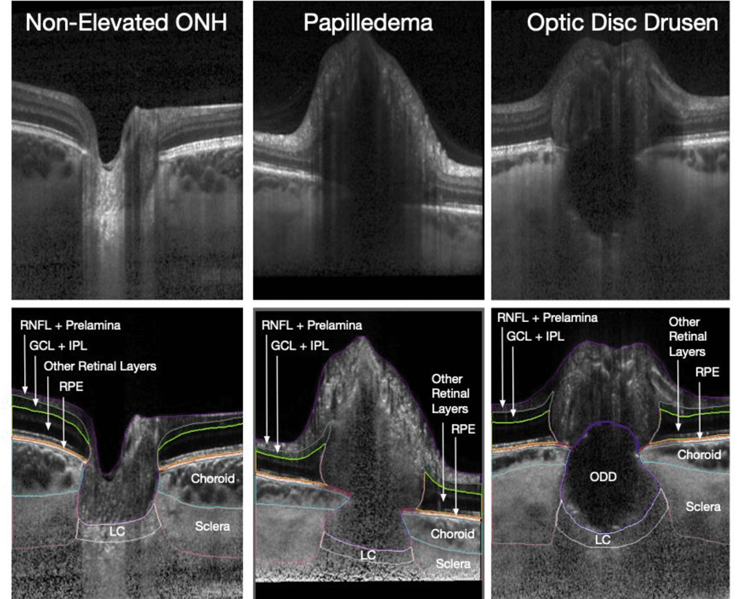 (Image used with permission of Michaël J.A. Girard, MSc, PhD)