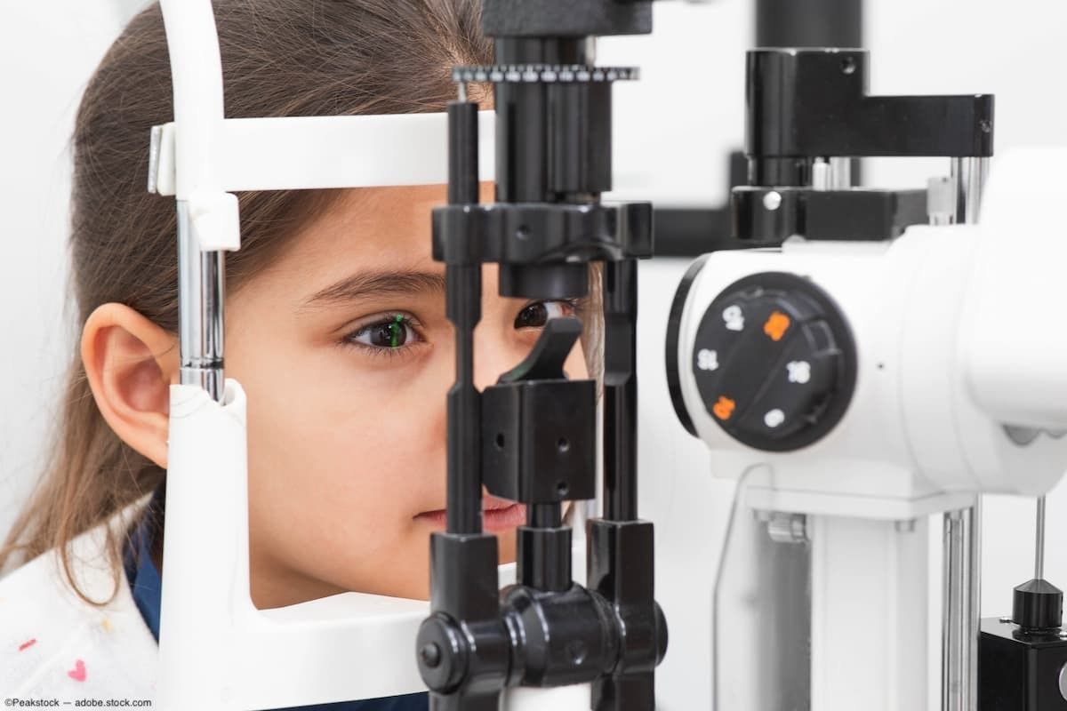 Research highlights retinal detachment risks in pediatric Marfan Syndrome patients following lens removal