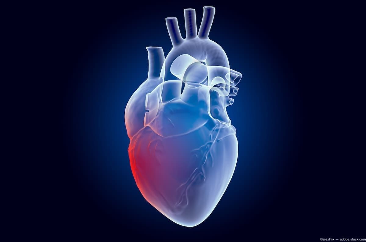 AAO 2024: Cardiac arrhythmias are associated with AMD